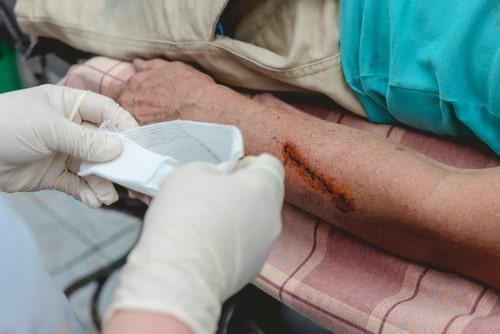 Kane County dog bite injury lawyer